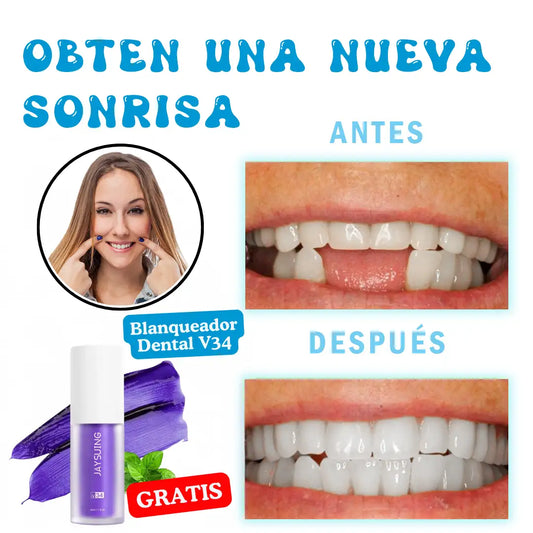 ORIGINAL MOLDATEET®️  ➕ Blanqueador Dental V34 GRATIS - RECUPERA TU SONRISA AL INSTANTE😀